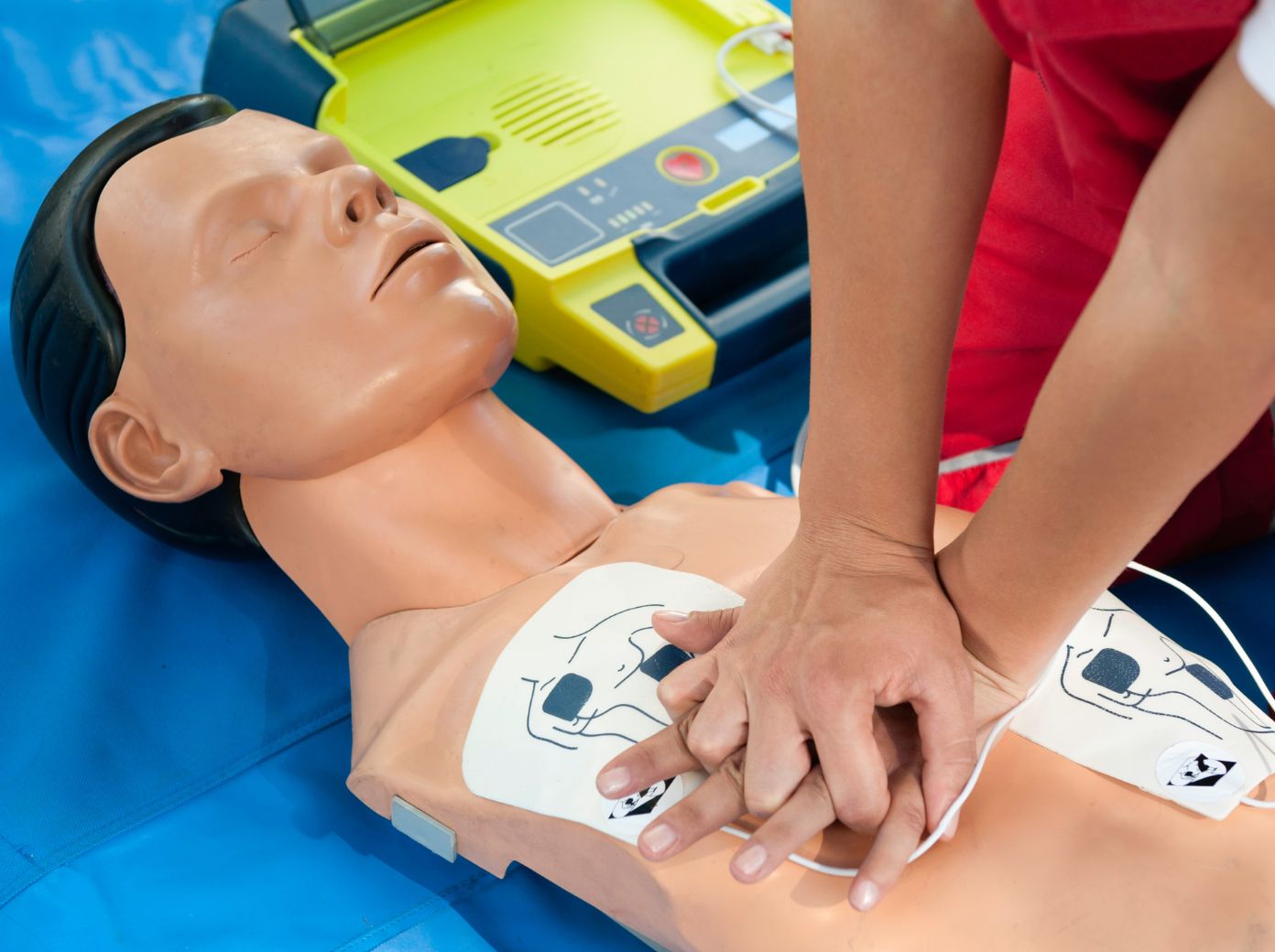 Person performing cardiopulmonary resuscitation (CPR) chest compressions on a training manikin with automated external defibrillator (AED) pads attached to the chest. An open AED is positioned beside the manikin during a first aid training session.